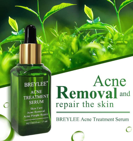 https://static.hzpdex.com/434cbd97-1dd7-418e-b811-bda97fa8dc26.jpg